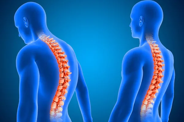 Spine Related Problems Neck Pain Back Pain Disc Related Problems