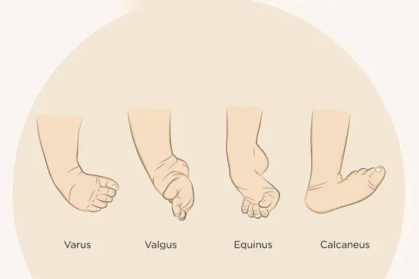 CTEV